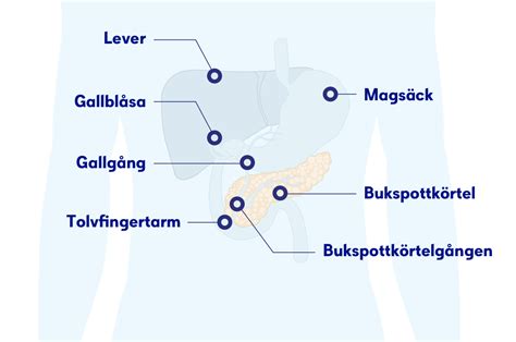 buksp|Cancer i bukspottkörteln .